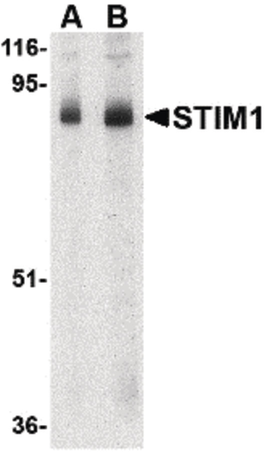 GOK / STIM1 Antibody - Western blot of STIM1 in mouse thymus tissue lysate with STIM1 antibody at (A) 1 and (B) 2 ug/ml.