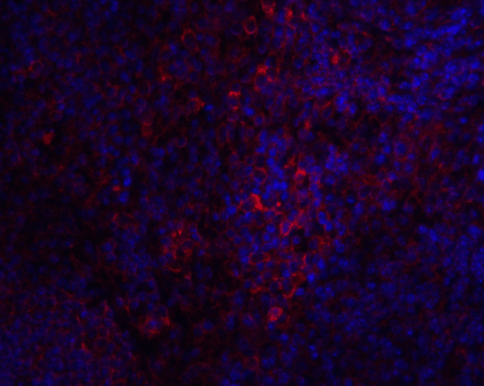 GOK / STIM1 Antibody - Immunofluorescence of STIM1 in mouse spleen tissue with STIM1 antibody at 20 ug/mL.  Green: STIM1 Antibody  Blue: DAPI staining