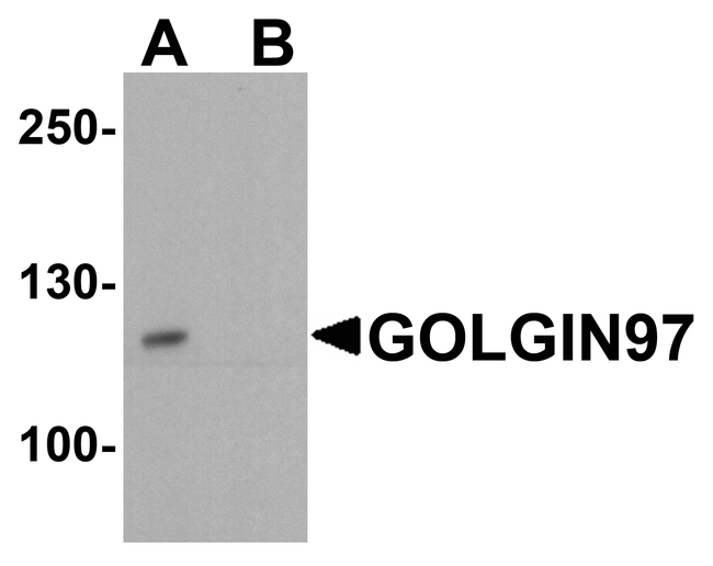 GOLGA1 / Golgin-97 Antibody - Western blot analysis of GOLGIN97 in human stomach tissue lysate with GOLGIN97 antibody at 1 ug/ml in (A) the absence and (B) the presence of blocking petpide.