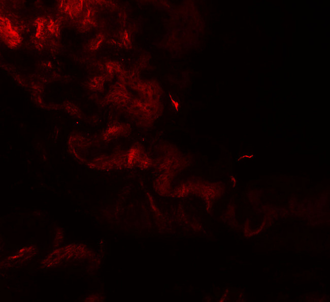 GOLGA1 / Golgin-97 Antibody - Immunofluorescence of GOLGIN97 in rat stomach tissue with GOLGIN97 antibody at 20 ug/mL.