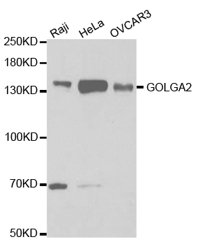 GOLGA2 / GM130 Antibody - Western blot analysis of extracts of various cell lines, using GOLGA2 antibody.