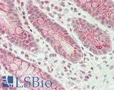 GOLGA2 / GM130 Antibody - Human Small Intestine: Formalin-Fixed, Paraffin-Embedded (FFPE)
