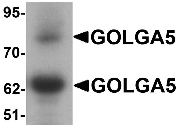 GOLGA5 Antibody - Western blot analysis of GOLGA5 in human testis tissue lysate with GOLGA5 antibody at 1 ug/ml.