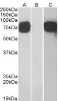 GOLM1 / GP73 / GOLPH2 Antibody - HEK293 lysate (10 ug protein in RIPA buffer) overexpressing Human GOLM1 with C-terminal MYC tag probed with anti-GOLM1 antibody (1 ug/ml) in Lane A and probed with anti-MYC Tag (1/1000) in lane C. Mock-transfected HEK293 probed with anti-GOLM1 antibody (1 mg/ml) in Lane B. Primary incubations were for 1 hour. Detected by chemiluminescence.