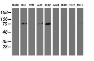 GOLM1 / GP73 / GOLPH2 Antibody - Western blot of extracts (35 ug) from 9 different cell lines by using anti-GOLM1 monoclonal antibody.