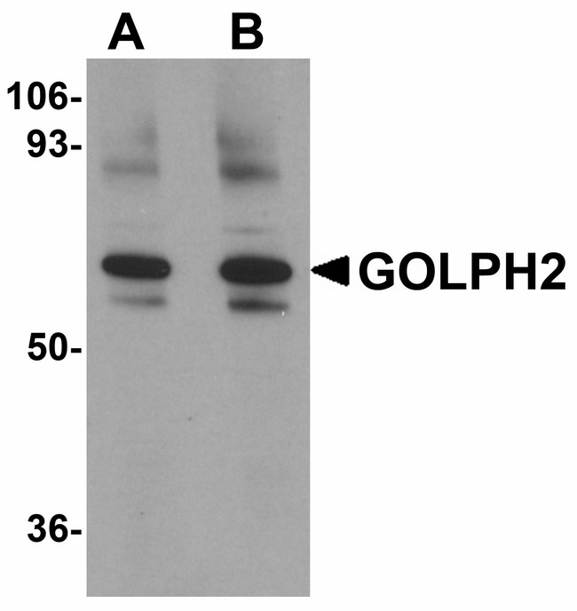 GOLM1 / GP73 / GOLPH2 Antibody - Western blot of GOLPH2 in rat brain tissue lysate with GOLPH2 antibody at (A) 0.25 and (B) 0.5 ug/ml.