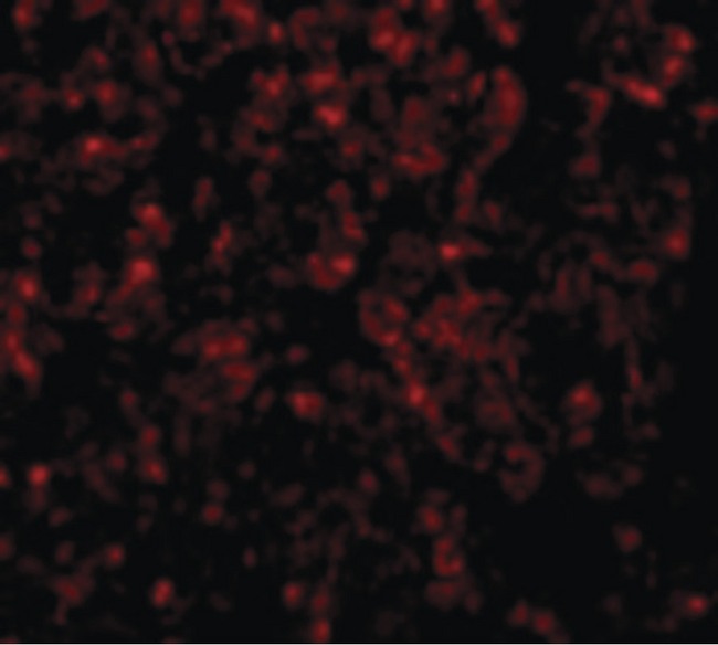 GOLPH3 Antibody - Immunofluorescence of GOLPH3 in Rat Lung cells with GOLPH3 antibody at 20 ug/ml.