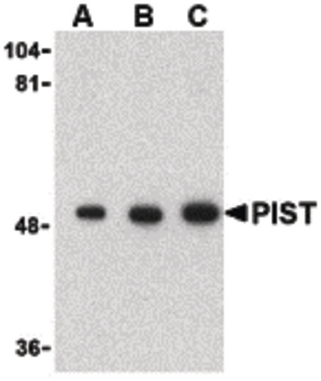 GOPC / PIST Antibody - Western blot of PIST in rat colon cell lysate with PIST antibody at (A) 1, (B) 2 and (C) 4 ug/ml.