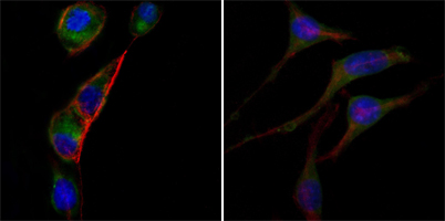 GOT2 Antibody - Immunofluorescence of PC-3 (left) and SK-BR-3 (right) cells using anti-GOT2 monoclonal antibody (green). Red: Actin filaments have been labeled with DY-554 phalloidin. Blue: DRAQ5 fluorescent DNA dye.