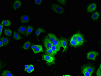 GOT2 Antibody - Immunofluorescent analysis of MCF-7 cells using GOT2 Antibody at dilution of 1:100 and Alexa Fluor 488-congugated AffiniPure Goat Anti-Rabbit IgG(H+L)