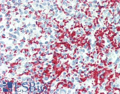 GP1BA / CD42b Antibody - Human Spleen: Formalin-Fixed, Paraffin-Embedded (FFPE), at a dilution of 1:100.