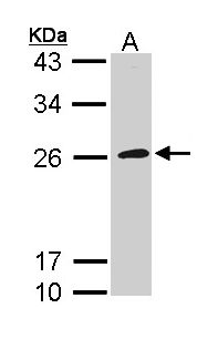 GP1BB / CD42c Antibody - Sample (30 ug of whole cell lysate). A: Raji. 12% SDS PAGE. GP1BB antibody diluted at 1:1000. 