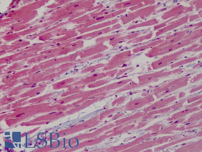 GP1BB / CD42c Antibody - Anti-GP1BB / CD42c antibody IHC of human heart. Immunohistochemistry of formalin-fixed, paraffin-embedded tissue after heat-induced antigen retrieval. Antibody concentration 10 ug/ml.