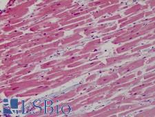 GP1BB / CD42c Antibody - Anti-GP1BB / CD42c antibody IHC of human heart. Immunohistochemistry of formalin-fixed, paraffin-embedded tissue after heat-induced antigen retrieval. Antibody concentration 10 ug/ml.