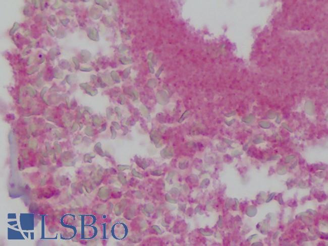 GP1BB / CD42c Antibody - Anti-GP1BB / CD42c antibody IHC of human colon. Immunohistochemistry of formalin-fixed, paraffin-embedded tissue after heat-induced antigen retrieval. Antibody concentration 10 ug/ml.