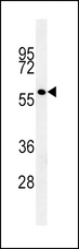 GP6 / GPVI Antibody - GP6 Antibody western blot of K562 cell line lysates (15 ug/lane). The GP6 antibody detected the GP6 protein (arrow).