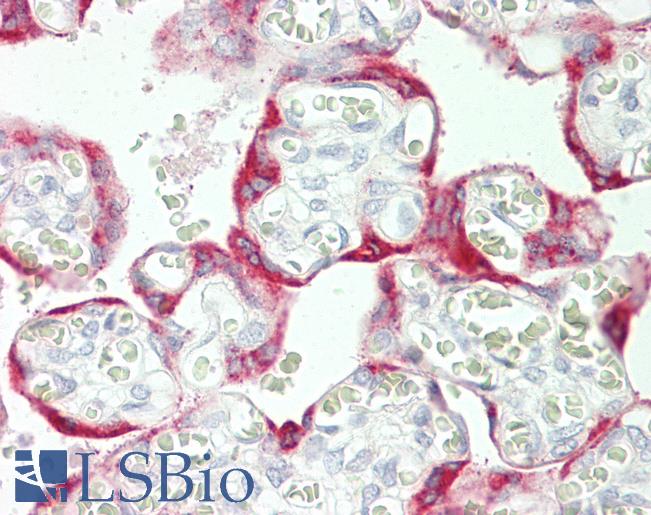 GP78 / AMFR Antibody - Anti-GP78 / AMFR antibody IHC staining of human placenta. Immunohistochemistry of formalin-fixed, paraffin-embedded tissue after heat-induced antigen retrieval. Antibody dilution 1:50.