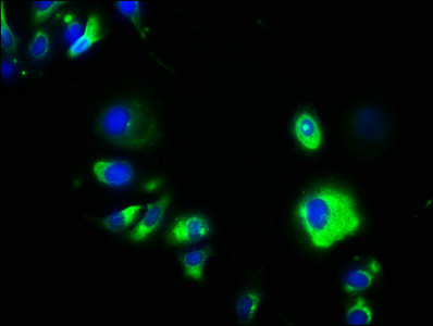GPA33 / A33 Antibody - Immunofluorescence staining of MCF-7 cells with GPA33 Antibody at 1:133, counter-stained with DAPI. The cells were fixed in 4% formaldehyde, permeabilized using 0.2% Triton X-100 and blocked in 10% normal Goat Serum. The cells were then incubated with the antibody overnight at 4°C. The secondary antibody was Alexa Fluor 488-congugated AffiniPure Goat Anti-Rabbit IgG(H+L).