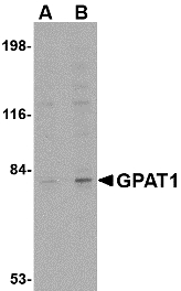 GPAM Antibody - Western blot of GPAT1 in rat brain tissue lysate with GPAT1 antibody at (A) 1 and (B) 2 ug/ml.