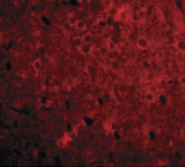 GPAM Antibody - Immunofluorescence of GPAT1 in Rat Brain cells with GPAT1 antibody at 20 ug/ml.
