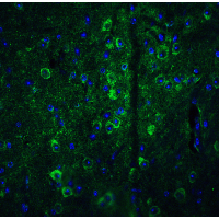 GPAM Antibody - Immunofluorescence of GPAT1 in mouse brain tissue with GPAT1 antibody at 20 µg/mL. Green: GPAT1 Antibody  Blue: DAPI staining