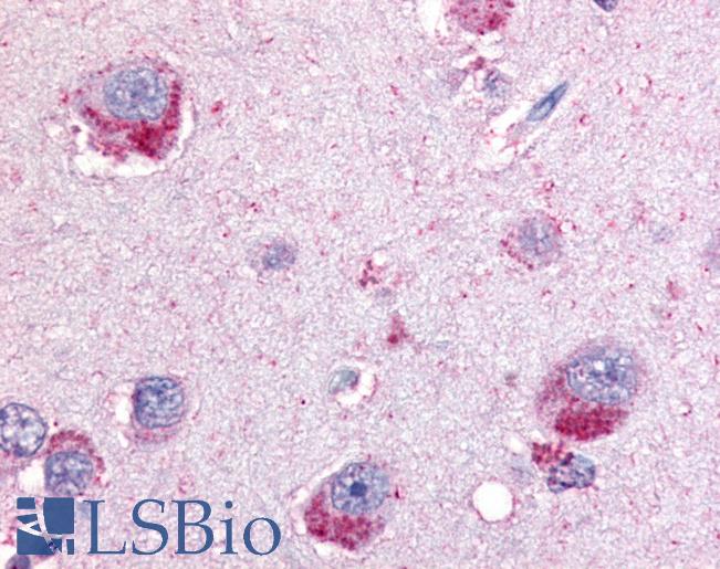GPBB / PYGB Antibody - Anti-PYGB antibody IHC of human brain. Immunohistochemistry of formalin-fixed, paraffin-embedded tissue after heat-induced antigen retrieval.