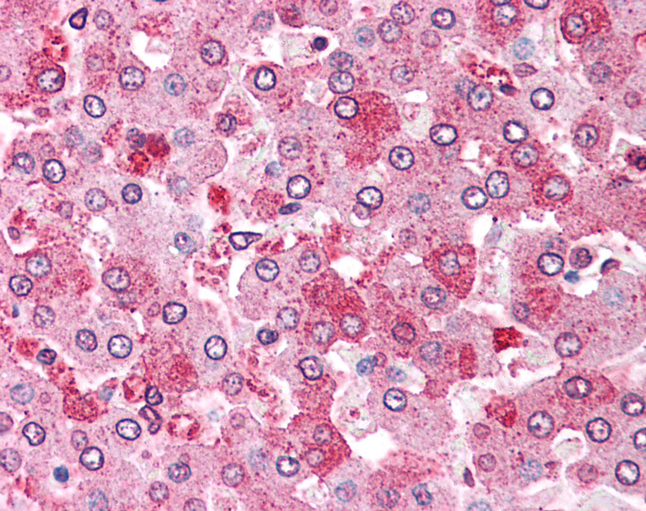 GPC4 / Glypican 4 Antibody - Anti-GPC4 / Glypican 4 antibody IHC of human liver. Immunohistochemistry of formalin-fixed, paraffin-embedded tissue after heat-induced antigen retrieval.