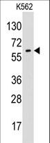 GPC6 / Glypican 6 Antibody - Western blot of anti-GPC6 antibody in K562 cell line lysates (35 ug/lane). GPC6(arrow) was detected using the purified antibody.