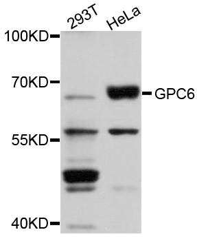 GPC6 / Glypican 6 Antibody - Western blot analysis of extracts of various cells.