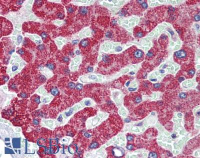 GPC6 / Glypican 6 Antibody - Human Liver: Formalin-Fixed, Paraffin-Embedded (FFPE)