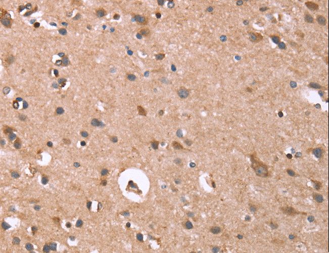 GPC6 / Glypican 6 Antibody - Immunohistochemistry of paraffin-embedded Human brain using GPC6 Polyclonal Antibody at dilution of 1:40.