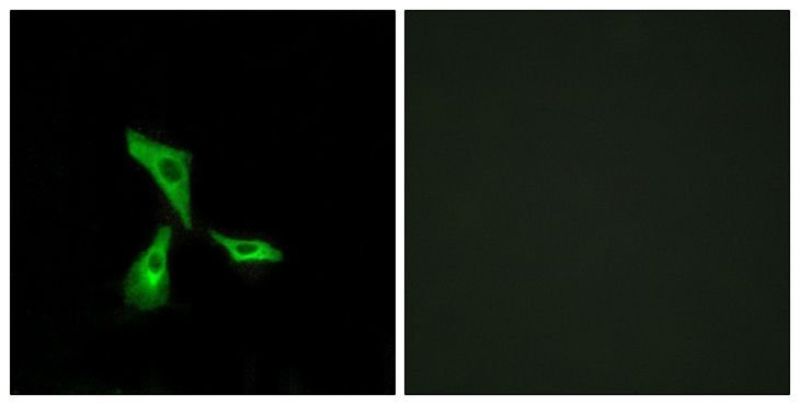 GPCR6 / GPR101 Antibody - Immunofluorescence analysis of HeLa cells, using GPR101 Antibody. The picture on the right is blocked with the synthesized peptide.