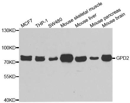 GPD2 Antibody - Western blot analysis of extracts of various cell lines.