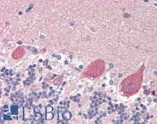 GPD2 Antibody - Human Brain, Cerebellum: Formalin-Fixed, Paraffin-Embedded (FFPE)