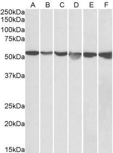 GPI Antibody - Goat Anti-GPI / Neuroleukin (aa81-93) Antibody (0.05µg/ml) staining of HeLa (A), A431 (B), A549 (C), MCF7 (D), Jurkat (E) and K562 (F) lysates (35µg protein in RIPA buffer). Detected by chemiluminescencence.