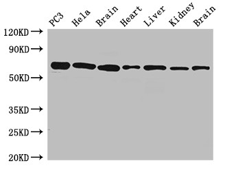 GPI Antibody - Positive WB detected in: PC3 whole cell lysate,Hela whole cell lysate,Rat brain tissue,Mouse heart tissue,Mouse liver tissue,Mouse kidney tissue,Mouse brain tissue All lanes: GPI antibody at 2.7ug/ml Secondary Goat polyclonal to rabbit IgG at 1/50000 dilution Predicted band size: 64 KDa Observed band size: 64 KDa