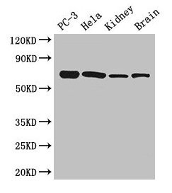 GPI Antibody - Western Blot Positive WB detected in: PC-3 whole cell lysate, Hela whole cell lysate, Rat brain tissue, Mouse heart tissue, Mouse liver tissue, Mouse kidney tissue, Mouse brain tissue All lanes: GPI antibody at 2.7µg/ml Secondary Goat polyclonal to rabbit IgG at 1/50000 dilution Predicted band size: 64 kDa Observed band size: 64 kDa
