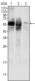 GPI Antibody - Western blot using GPI mouse monoclonal antibody against HepG2 (1) , SMMC-7721 (2) cell lysate and rat liver tissues lysate (3).