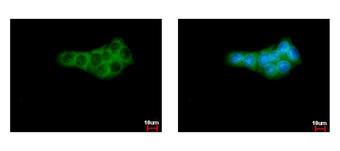 GPI Antibody - GPI antibody detects GPI protein at cytoplasm by immunofluorescent analysis. Sample: HepG2 cells were fixed in ice-cold MeOH for 5 min. Green: GPI protein stained by Anti-GPI antibody diluted at 1:500. Blue: Hoechst 33342 staining.