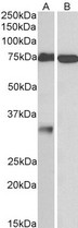 GPM6A / Glycoprotein M6A Antibody - Goat Anti-GPM6A Antibody (1µg/ml) staining of Human Cerebellum (A) and Olfactory Bulb (B) lysates (35µg protein in RIPA buffer). Primary incubation was 1 hour. Detected by chemiluminescencence.