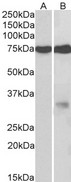 GPM6A / Glycoprotein M6A Antibody - Goat Anti-GPM6A Antibody (2µg/ml) staining of fetal Mouse (A) and Rat (B) Brain lysates (35µg protein in RIPA buffer). Primary incubation was 1 hour. Detected by chemiluminescencence.