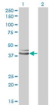 GPN1 / XAB1 Antibody - Western blot of XAB1 expression in transfected 293T cell line by XAB1 monoclonal antibody, clone 3E1.