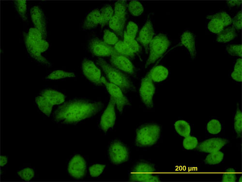GPN1 / XAB1 Antibody - Immunofluorescence of monoclonal antibody to XAB1 on HeLa cell (antibody concentration 10 ug/ml).