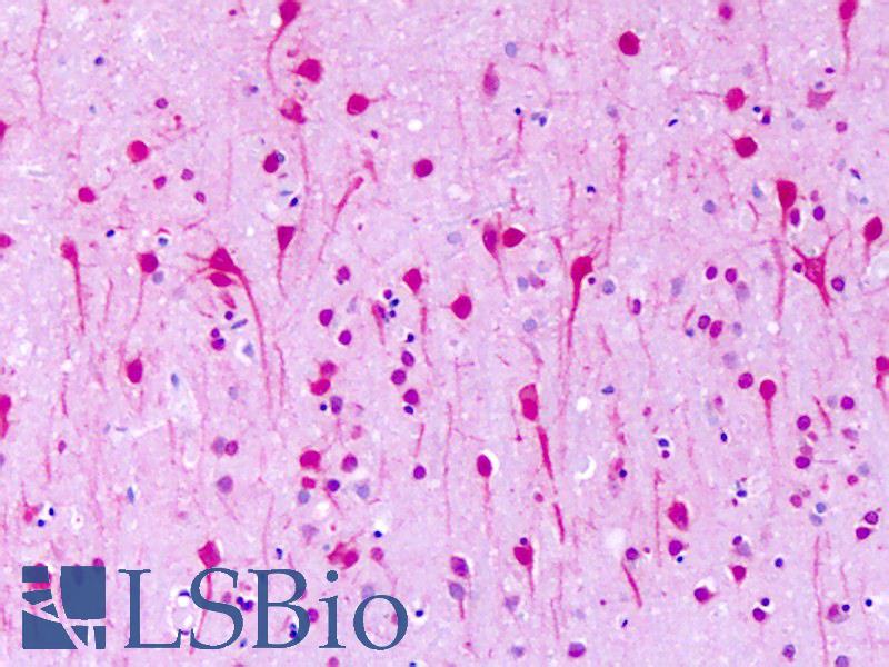 GPR1 Antibody - Anti-GPR1 antibody IHC of human brain, neurons. Immunohistochemistry of formalin-fixed, paraffin-embedded tissue after heat-induced antigen retrieval. Antibody dilution 32 ug/ml.