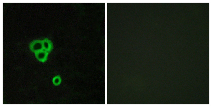 GPR119 Antibody - Immunofluorescence analysis of MCF7 cells, using GPR119 Antibody. The picture on the right is blocked with the synthesized peptide.