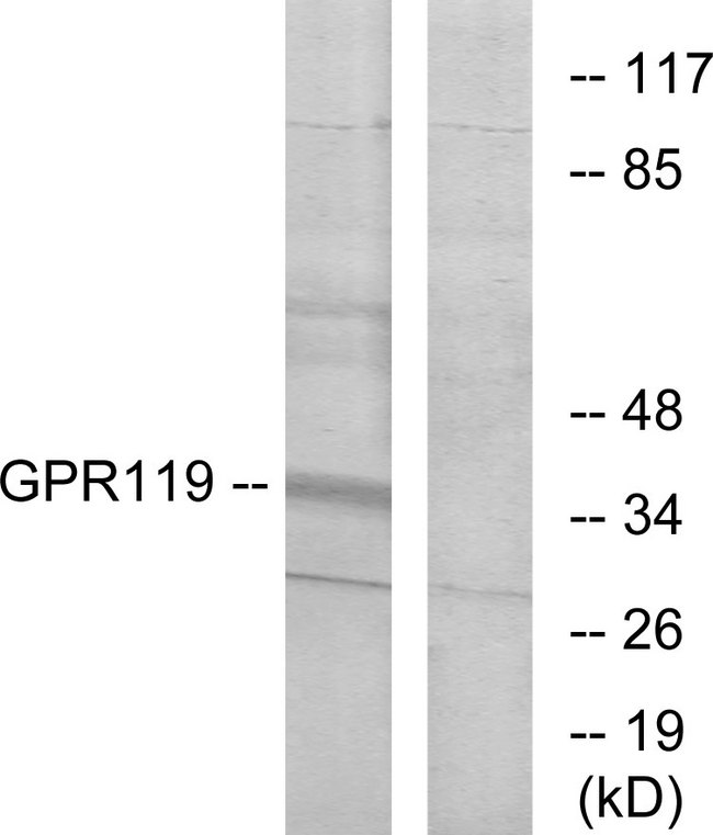 GPR119 Antibody - Western blot analysis of lysates from K562 cells, using GPR119 Antibody. The lane on the right is blocked with the synthesized peptide.