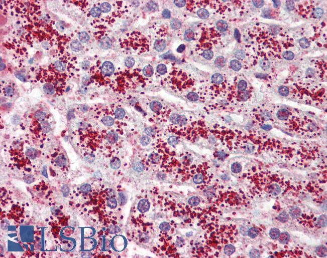 GPR119 Antibody - Anti-GPR119 antibody IHC of human liver. Immunohistochemistry of formalin-fixed, paraffin-embedded tissue after heat-induced antigen retrieval.