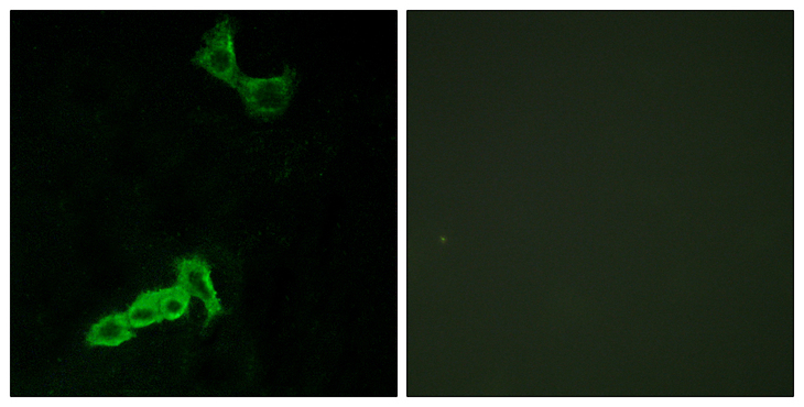 GPR137C / TM7SF1L2 Antibody - Immunofluorescence analysis of MCF7 cells, using GPR137C Antibody. The picture on the right is blocked with the synthesized peptide.