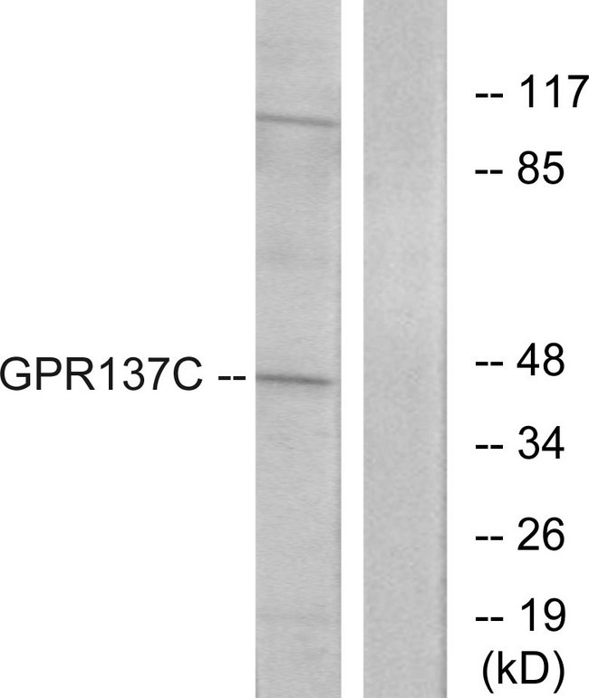 GPR137C / TM7SF1L2 Antibody - Western blot analysis of lysates from HepG2 cells, using GPR137C Antibody. The lane on the right is blocked with the synthesized peptide.