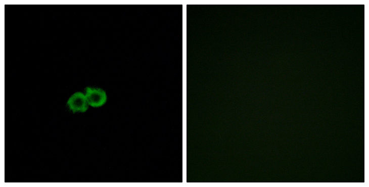 GPR142 Antibody - Immunofluorescence analysis of A549 cells, using GPR142 Antibody. The picture on the right is blocked with the synthesized peptide.